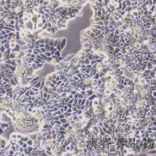 T47D 人乳腺导管癌细胞