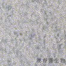 293 HEK-293（人胚肾细胞）