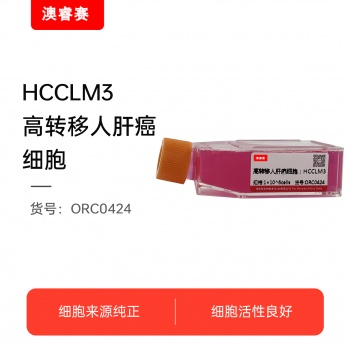 HCCLM3  高转移人肝癌细胞