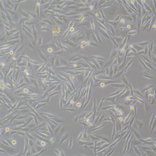 MDA-MB-231-luc  人乳腺癌细胞-荧光素酶标记