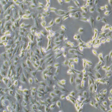 786-O  786-0  （人肾透明细胞腺癌细胞）