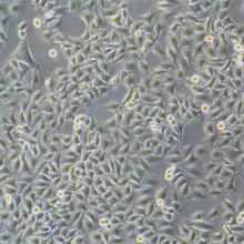 SMMC-7721  人肝癌细胞