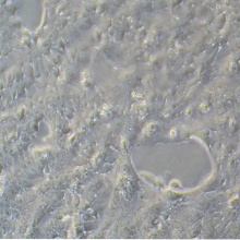 NCI-H441  人肺腺癌细胞