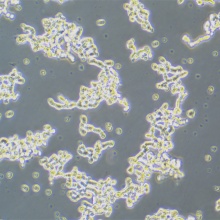 WERI-Rb-1  人视网膜母细胞瘤