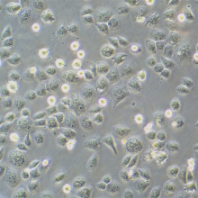 SK-LU-1   人低分化肺腺癌细胞