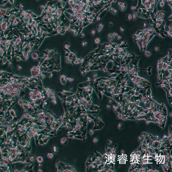 Hep G2 人肝癌细胞