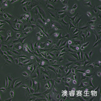 hRMECs 人视网膜微血管内皮细胞