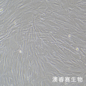 HTMC 人眼小梁网细胞