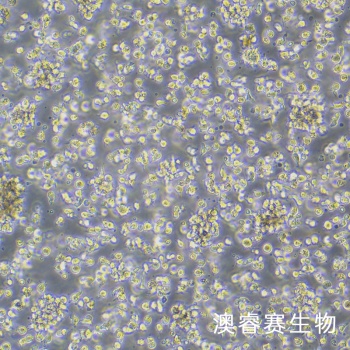SU-DHL-1细胞 人间变性大细胞淋巴瘤细胞
