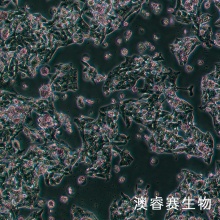 Hep G2 人肝癌细胞