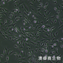 hRMECs 人视网膜微血管内皮细胞