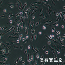 hRMECs 人视网膜微血管内皮细胞