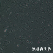 CCD-841CoN细胞；人正常结肠上皮细胞
