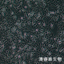 CTX TNA2细胞,大鼠星形胶质细胞