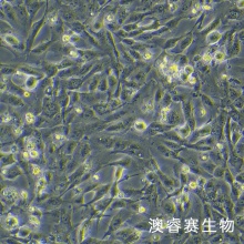 786-O  786-0  （人肾透明细胞腺癌细胞）