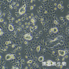 NCI-H508[H508]  人结肠直肠腺癌细胞