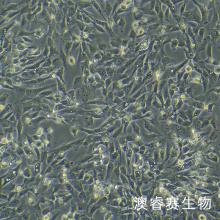 HDF-a 人真皮成纤维母细胞-新生 HDF-n