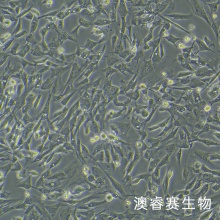 HDF-a 人真皮成纤维母细胞-新生 HDF-n