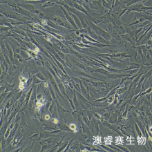 HSF 人皮肤成纤维细胞