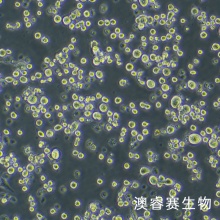 LLC小鼠肺癌细胞