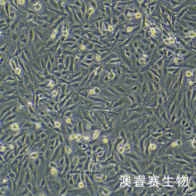 SV40-MES-13小鼠肾小球系膜细胞