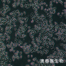 INS-1   大鼠胰岛细胞瘤细胞