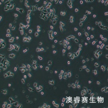INS-1   大鼠胰岛细胞瘤细胞