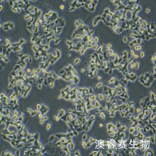 INS-1   大鼠胰岛细胞瘤细胞