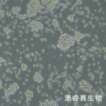 Jurkat   人急性T淋巴细胞白血病细胞