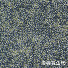 NG108-15 [108CC15]   小鼠神经细胞瘤与大鼠神经胶质瘤之融合细胞