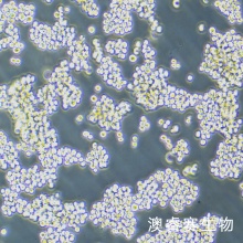 Walker/LLC-WRC 256 大鼠腹水癌细胞