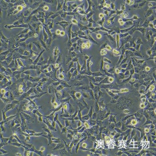 人绒毛膜滋养细胞；HTR-8/Svneo