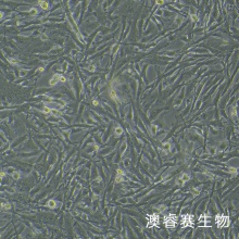 人神经胶质细胞瘤细胞带绿色荧光 ;U251/GFP