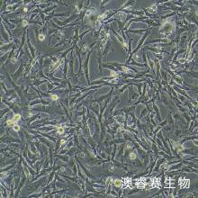 人神经胶质细胞瘤细胞带绿色荧光 ;U251/GFP