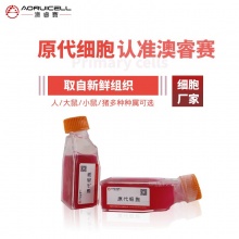 人脉络丛上皮细胞永生化