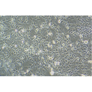 Hep3B-LUC（人肝癌细胞-荧光素酶标记）