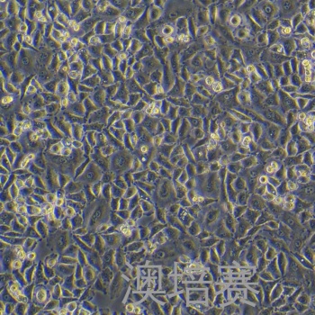 SNU668（人胃癌细胞）