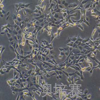 SUM149PT/GFP（人乳腺癌细胞-绿色荧光标记）