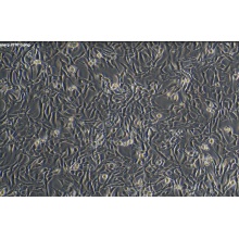 HepaRG（人肝癌细胞）