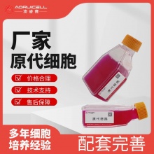 人乳腺成纤维细胞-GFP（绿色荧光蛋白）