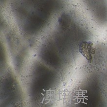 ECC12（人胃癌细胞）