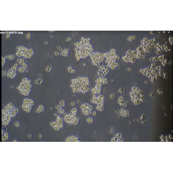 SHP-77 人小细胞肺癌细胞