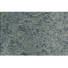 LUVA 细胞， 永生化人肥大细胞系