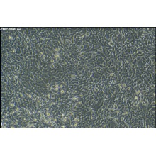 人心脏微血管内皮细胞永生化