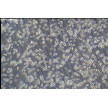 SHP-77-LUC（人小细胞肺癌细胞荧光素酶标记）