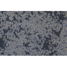 SHP-77-LUC（人小细胞肺癌细胞荧光素酶标记）